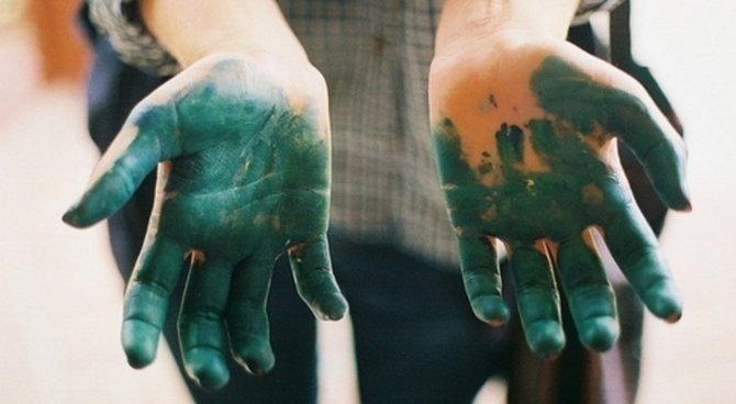 Руки в зеленке